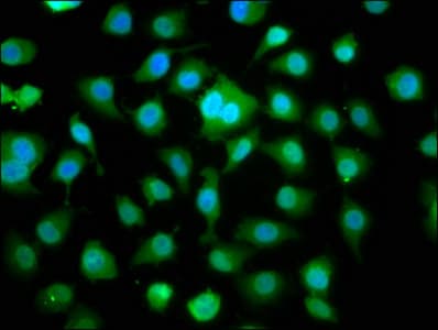 DMPK / DM Antibody