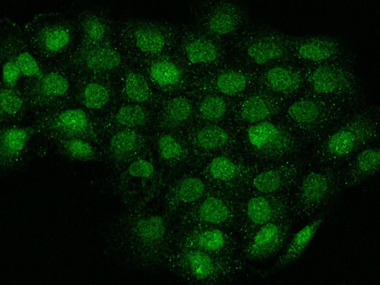 TMEM194A Antibody