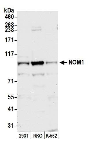 Polyclonal Rabbit anti-Human NOM1 Antibody (aa200-250, WB)