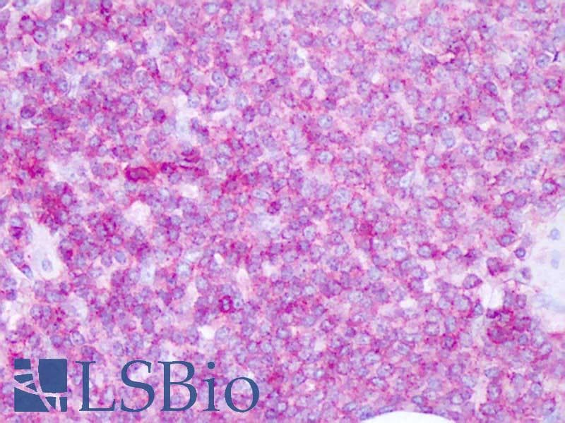 IHC-plus™ Polyclonal Rabbit anti-Human CD45 / LCA Antibody (Internal, IHC)