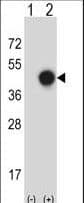 XPA Antibody (aa185-213)