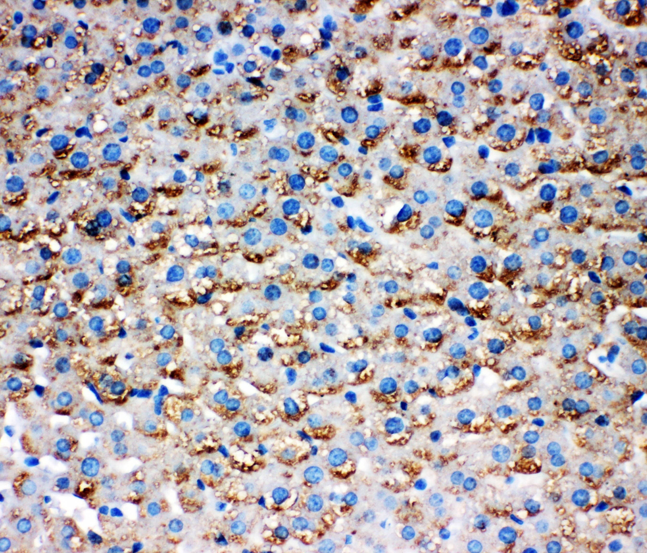 Polyclonal Rabbit anti-Human HSD17 / HSD17B1 Antibody (aa29-43, IHC, WB)