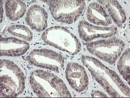 FBXO42 / JFK Antibody (clone OTI1H4)