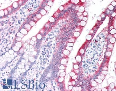 IHC-plus™ MTTP / MTP Antibody