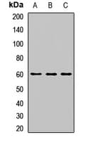 SOCS6 / SOCS-6 Antibody