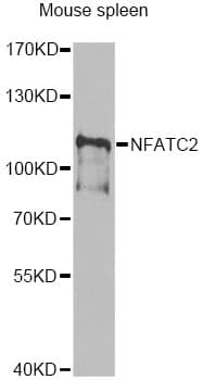 Polyclonal Rabbit anti-Human NFAT1 / NFATC2 Antibody (WB)