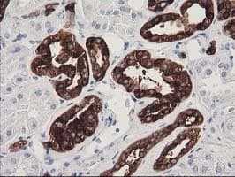 ATP6V1B1 Antibody (clone OTI1H6)