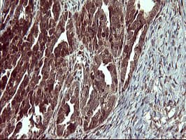 Monoclonal Mouse anti-Human MAP2K1 / MKK1 / MEK1 Antibody (clone OTI9E9, IHC, IF, WB)