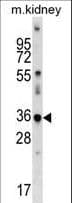 CDKL4 Antibody (aa272-299)