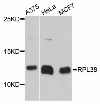 RPL38 / Ribosomal Protein L38 Antibody