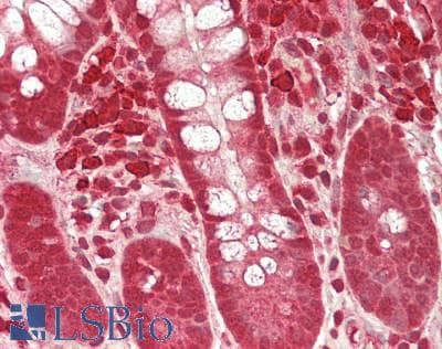 IHC-plus™ PBRM1 / BAF180 / PB1 Antibody (aa1-50)