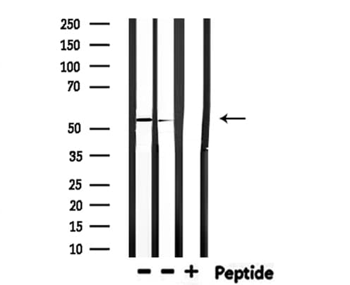 Polyclonal Rabbit anti-Human IKZF1 / IKAROS Antibody (IHC, WB)