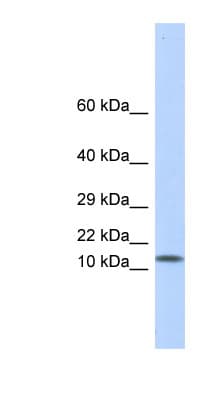 PathPlus™ LGALS1 / Galectin 1 Antibody (aa72-121)