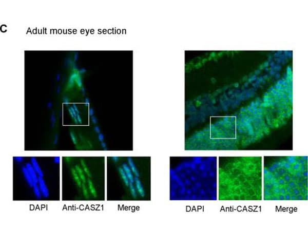 CASZ1 Antibody