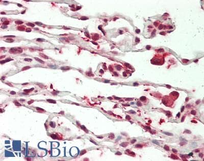 IHC-plus™ Polyclonal Rabbit anti-Human WTIP Antibody (aa243-271, IHC, IF, WB)