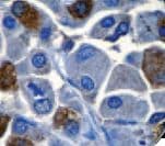 LH / Luteinizing Hormone Antibody (Ready-to-Use)
