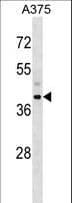 Polyclonal Rabbit anti-Human SNUPN Antibody (aa200-228, WB)