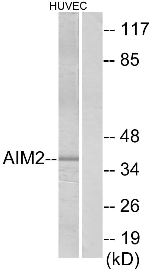 Polyclonal Rabbit anti-Human AIM2 Antibody (aa51-100, WB)