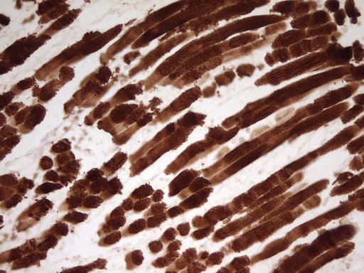 Monoclonal Mouse anti-Human TNNT2 / CTNT Antibody (clone OTI3C3, Carrier-free, IHC, WB)
