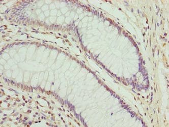 CPXCR1 / CT77 Antibody