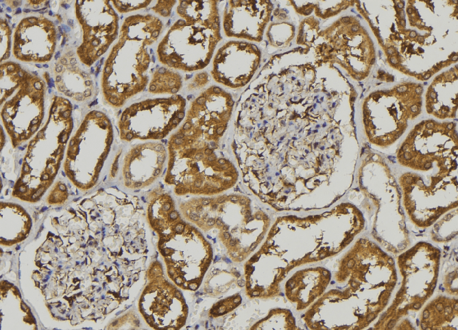 Pepsinogen A Antibody