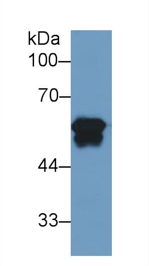 FGB / Fibrinogen Beta Chain Antibody (aa45-491)