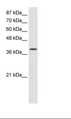 DAP-5 / EIF4G2 Antibody (aa766-815)