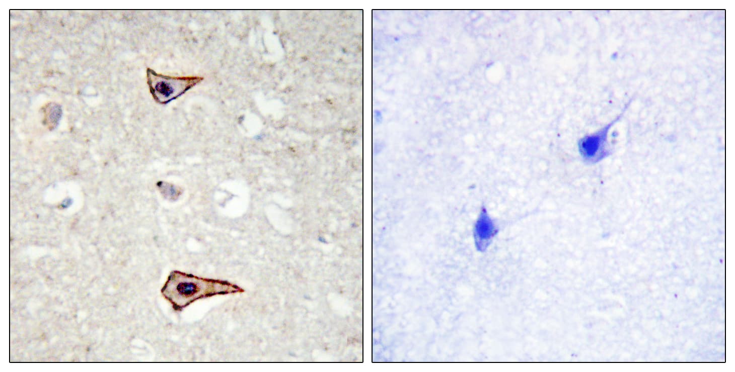 KCNA3 / Kv1.3 Antibody (phospho-Tyr135)