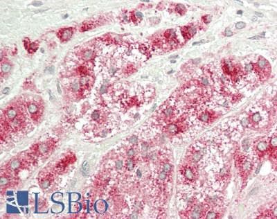 IHC-plus™ Polyclonal Rabbit anti-Human SGSH Antibody (IHC, WB)