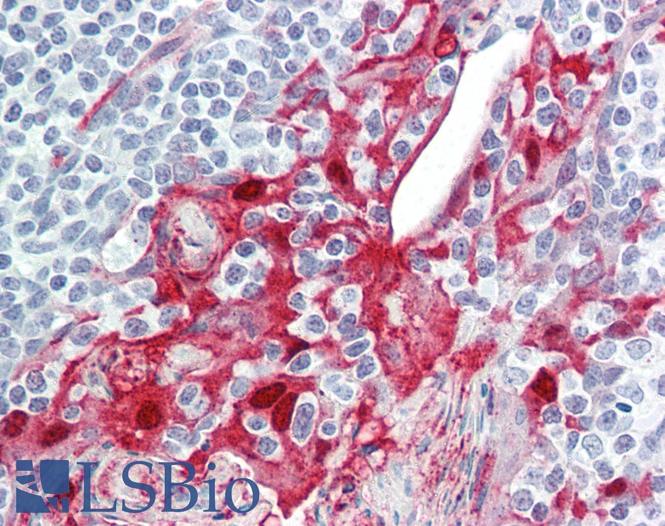 IHC-plus™ Monoclonal Rat anti-Human BAFF / TNFSF13B Antibody (clone Buffy-1, aa83-285, IHC, WB)