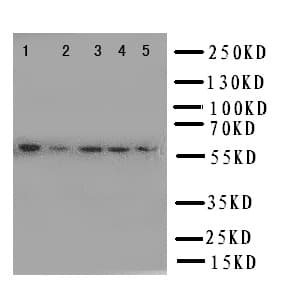 Polyclonal Rabbit anti-Human PDIA3 / ERp57 Antibody (aa172-188, IHC, WB)