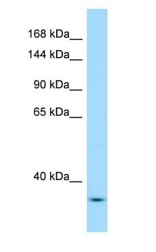 YEATS2 Antibody (aa102-151)