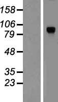 DYRK / DYRK1A Protein (Over-Expression Lysate Myc-DDK (Flag))