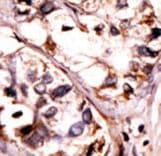 SYK Antibody (phospho-Tyr525/Tyr526)