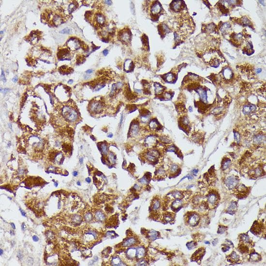 AGT / Angiotensinogen Antibody