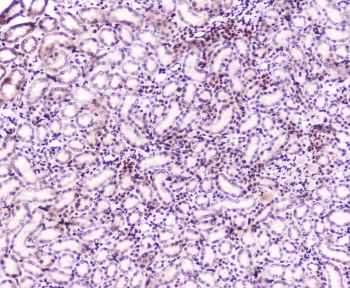 Polyclonal Rabbit anti-Mouse MEF2C Antibody (IHC, WB)
