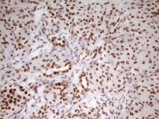 HMG20A Antibody (aa1-281, clone OTI2H4)