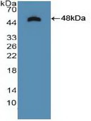 NTRK2 / TRKB Antibody (aa32-430)