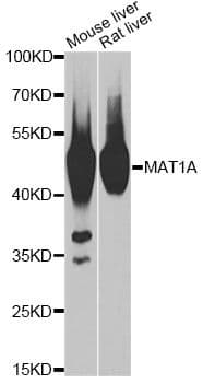 Polyclonal Rabbit anti-Human MAT / MAT1A Antibody (IHC, WB)