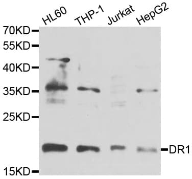 Polyclonal Rabbit anti-Human DR1 / NC2 Antibody (IHC, WB)