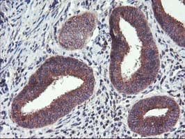 FGFR2 / FGF Receptor 2 Antibody (clone OTI5C5)