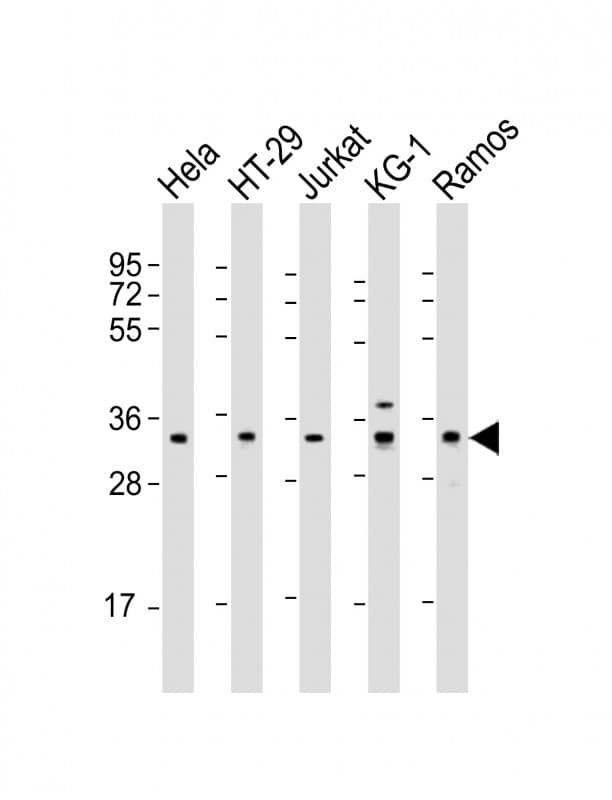 SPPL2B Antibody (aa126-160)