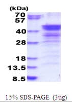 Human NUDEL / NDEL1 Protein (Recombinant His)