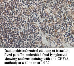 ZNF43 Antibody (aa39-294)