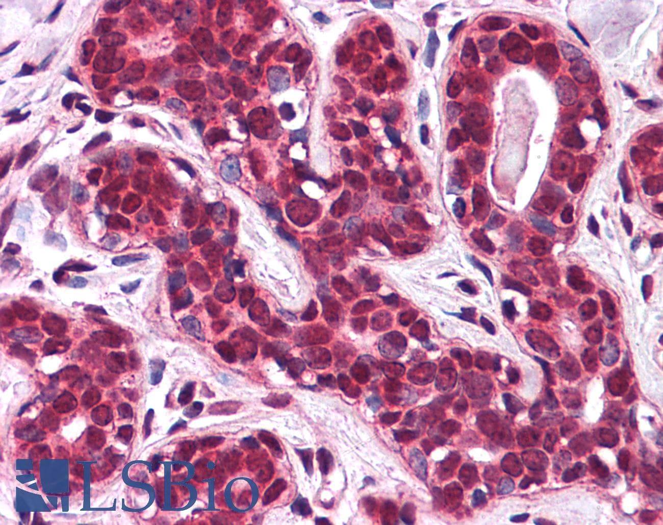 IHC-plus™ SLC5A6 / SMVT Antibody (N-Terminus)