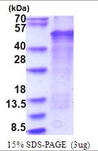 Human LMX1B Protein (Recombinant His)