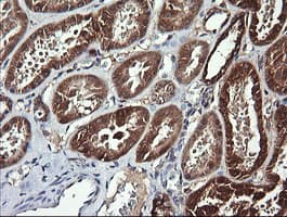 Monoclonal Mouse anti-Human ACAA2 Antibody (clone OTI2F6, IHC, IF, WB)