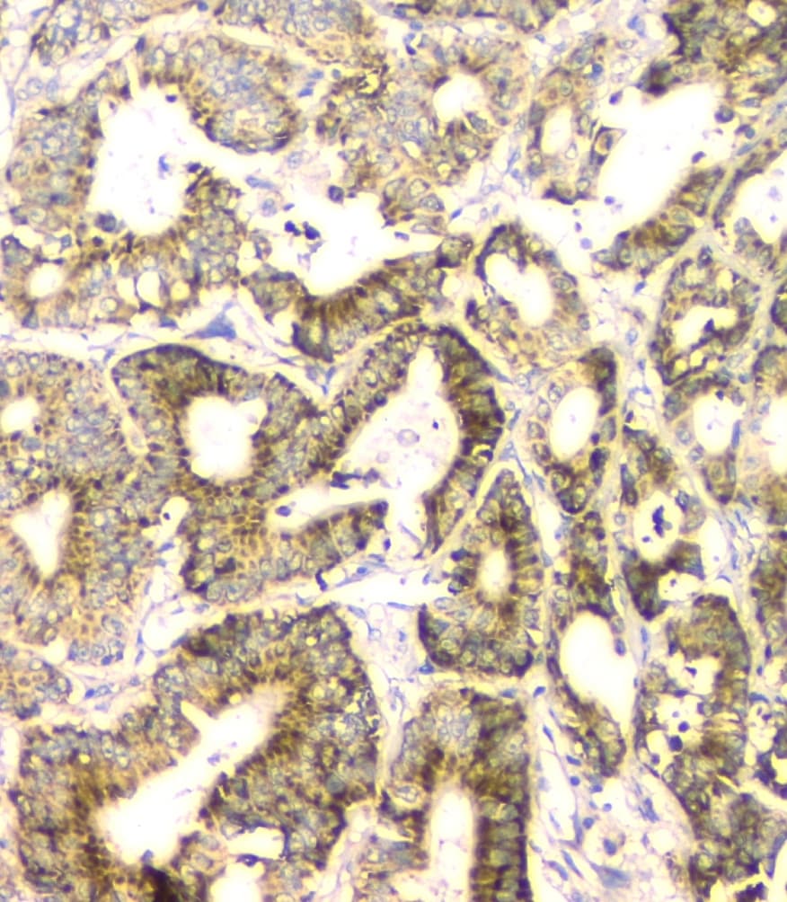 FH / Fumarase / MCL Antibody