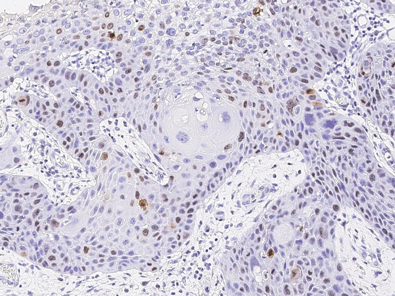 Monoclonal Mouse anti-Human MKI67 / Ki67 Antibody (clone 21, Preservative Free, IHC)