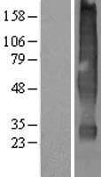 Human SLC22A18 Protein (Over-Expression Lysate Myc-DDK (Flag))